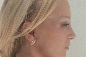 Rivera Plastic Surgery in Miami Beach