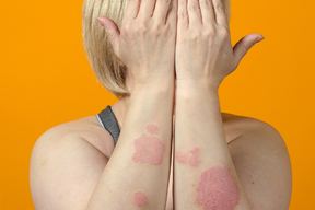 Skin Cancer Specialists in Sugar Land