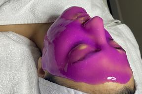 Skinovate Med Spa in Glendale