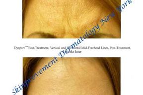 SkinProvement Dermatology New York in New York