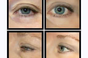 Tampa Bay Cosmetic Surgery Center in Clearwater
