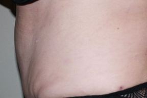 Zieg Plastic Surgery Center in Evansville