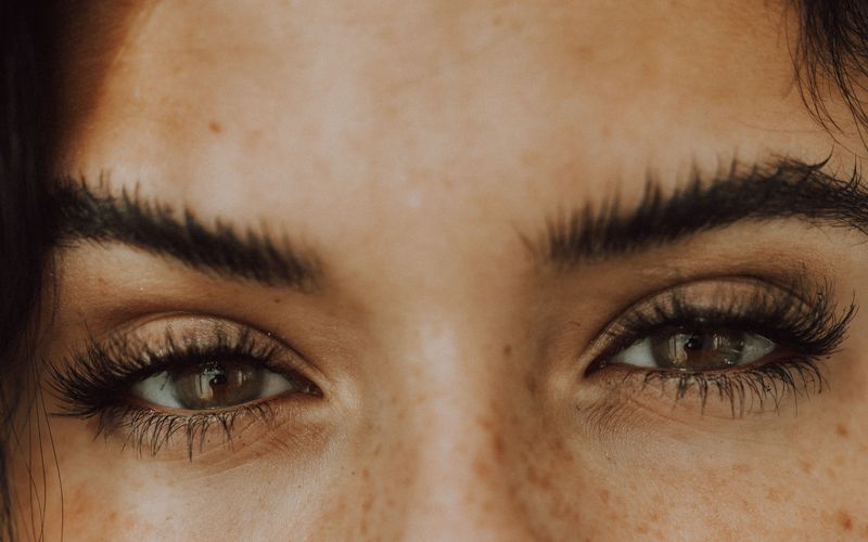 Brow Lift treatment