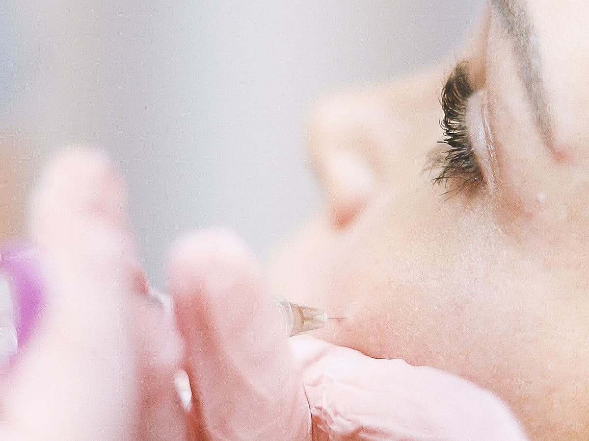 Cheek Filler