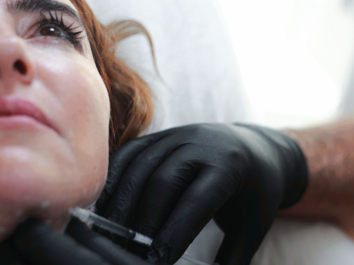 Chin Filler treatment