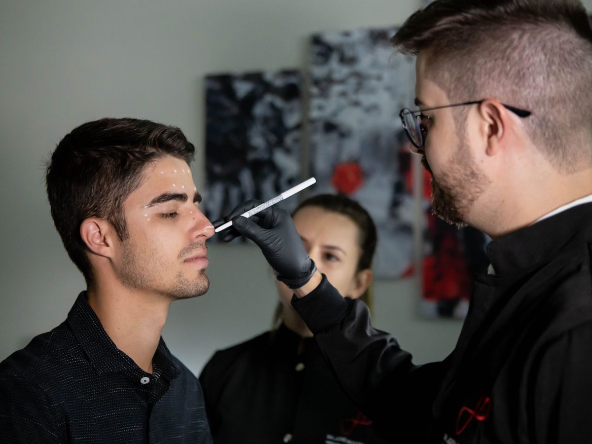Facial Fat Transfer treatment