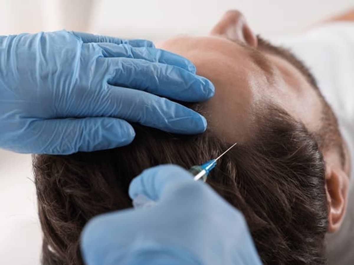 Hair Restoration