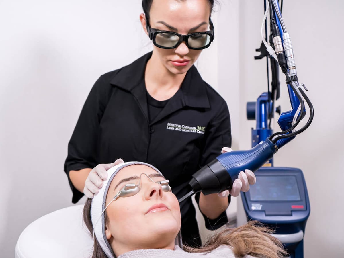 Laser Skin Resurfacing