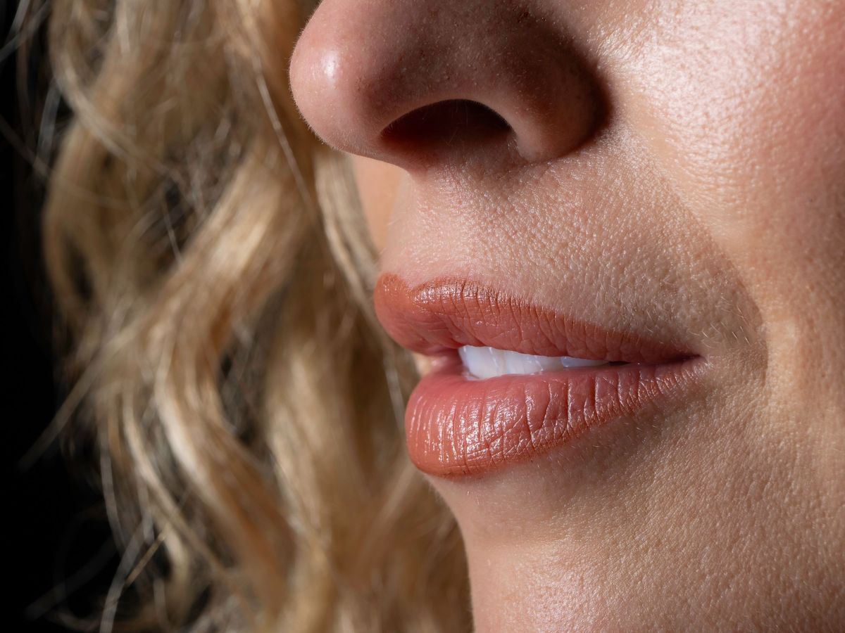 Lip Lift treatment
