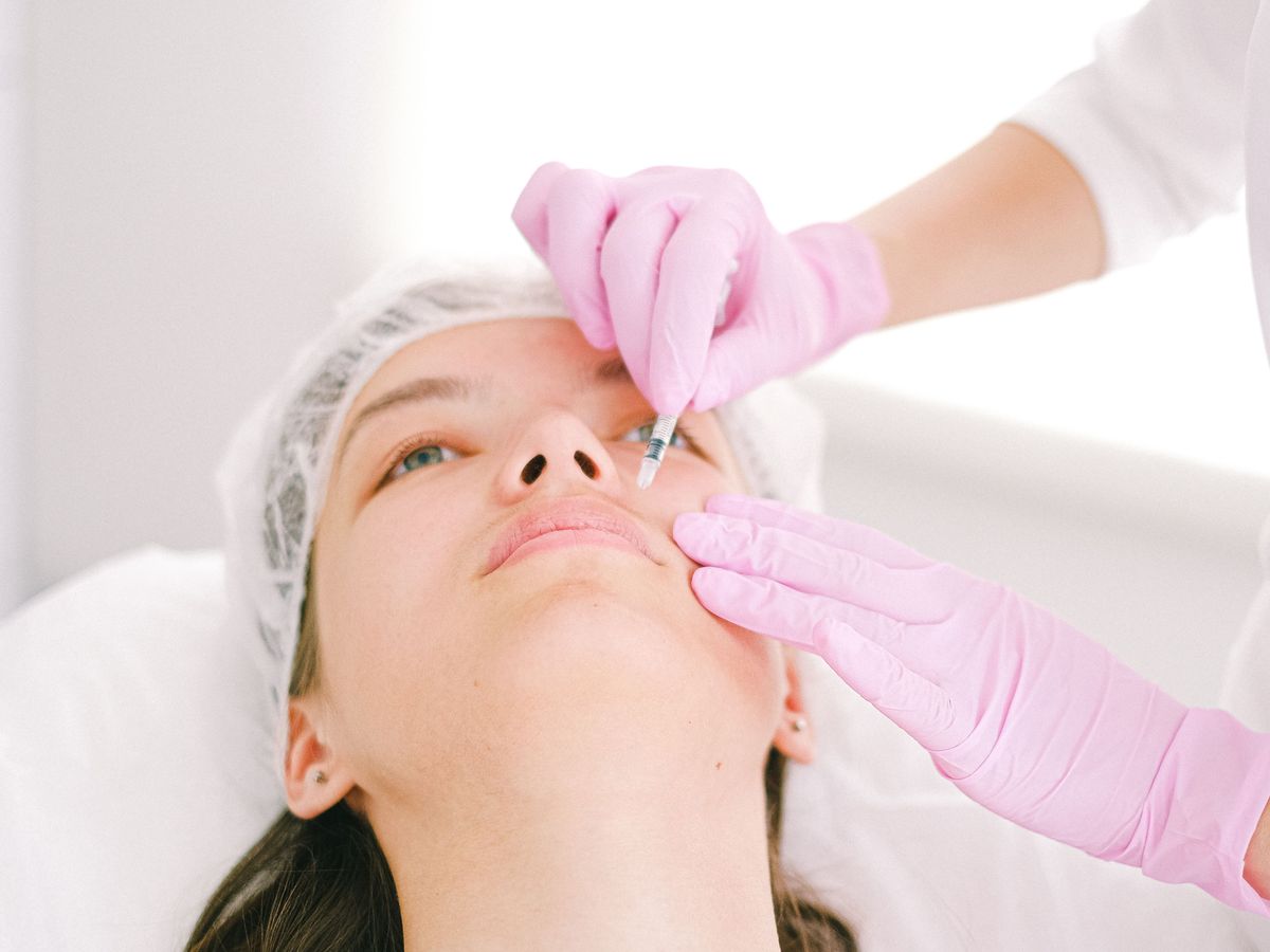Radiesse treatment