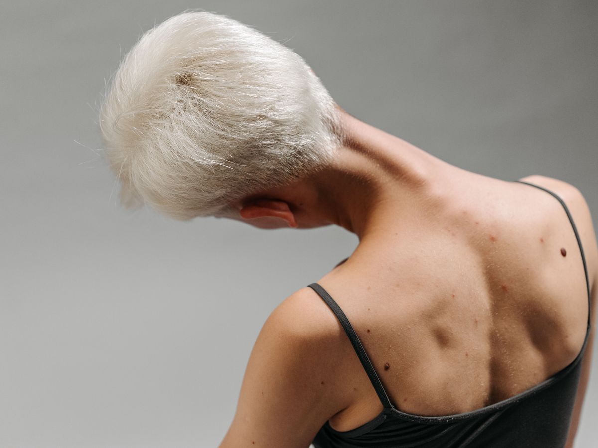 Trap Botox treatment