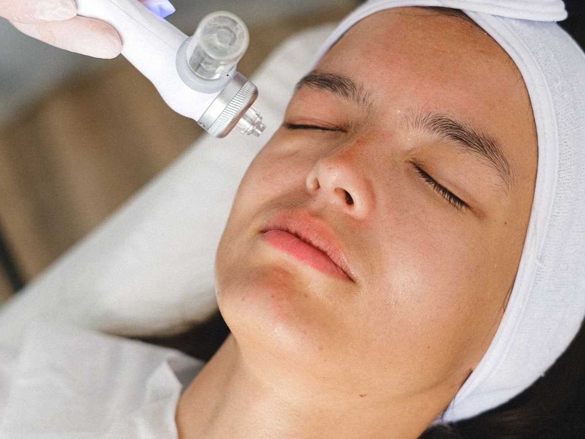 Ultherapy